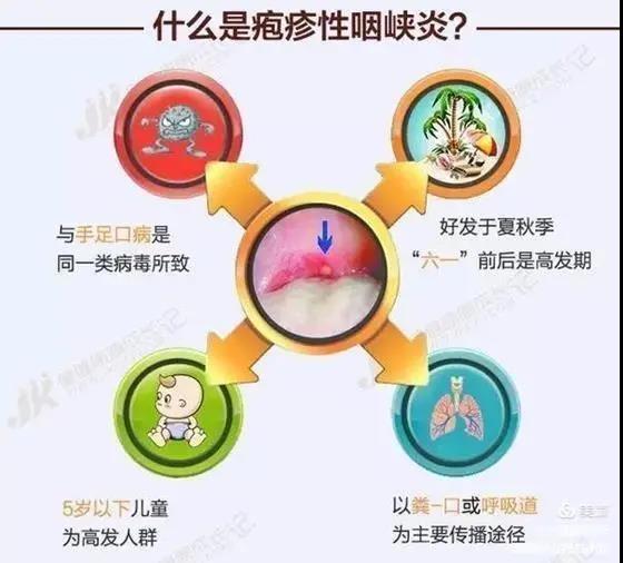 皰疹性咽峽炎及手足口病不用慌，紫外線燈來(lái)幫忙